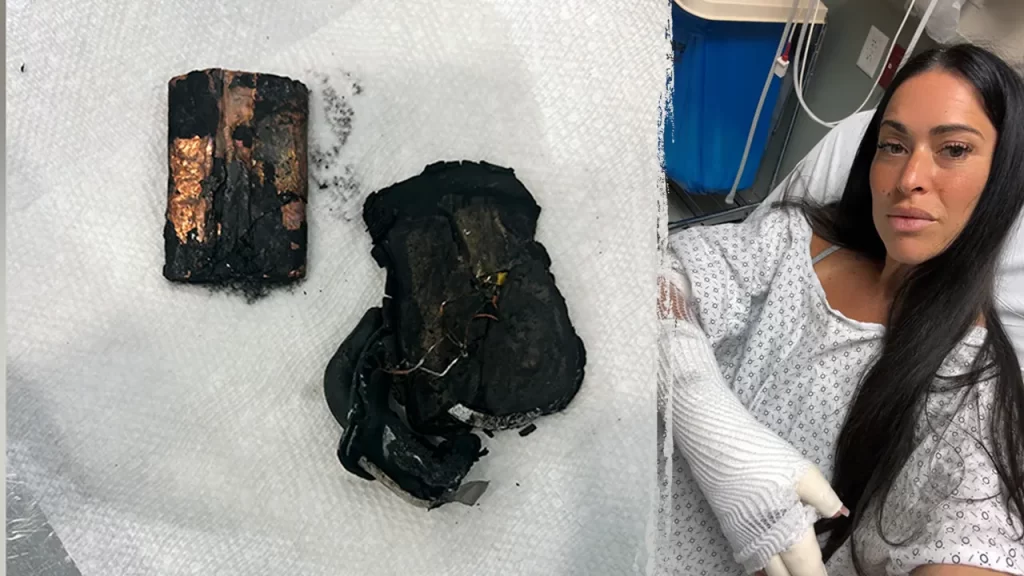 Portable charger explodes in bed, leaves woman with chemical burns 106 Portable charger explodes in bed, leaves woman with chemical burns